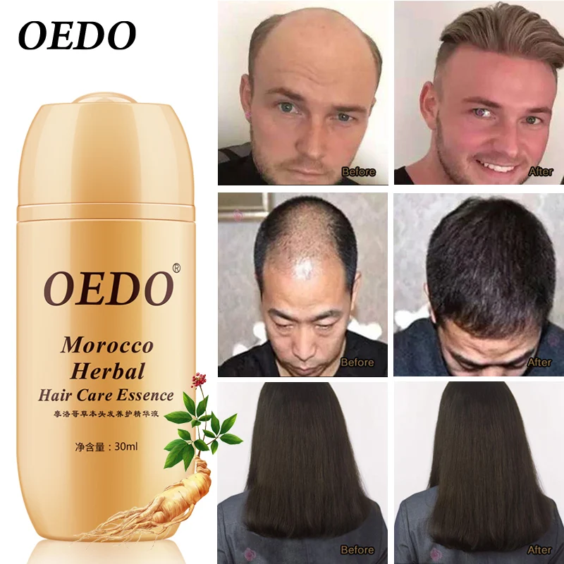 

Herbal Ginseng Keratin Hair Treatment For Men And Women Hair Loss Powerful Hair Care Growth Serum Repair Shampoo Lador