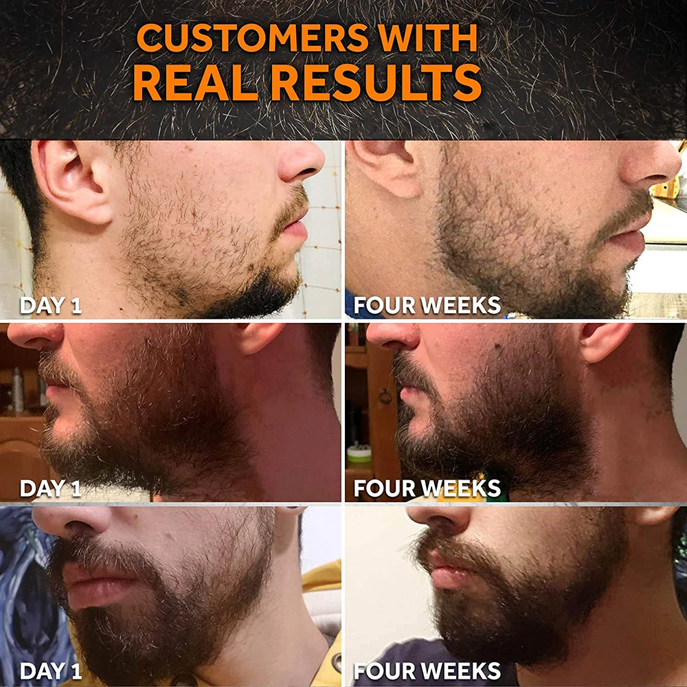 

4 pieces Men Beard Growth Kit Hair Growth Enhancer Essence Oil Nourishing Balm Conditioner with Comb Roller Facial Care Dropship