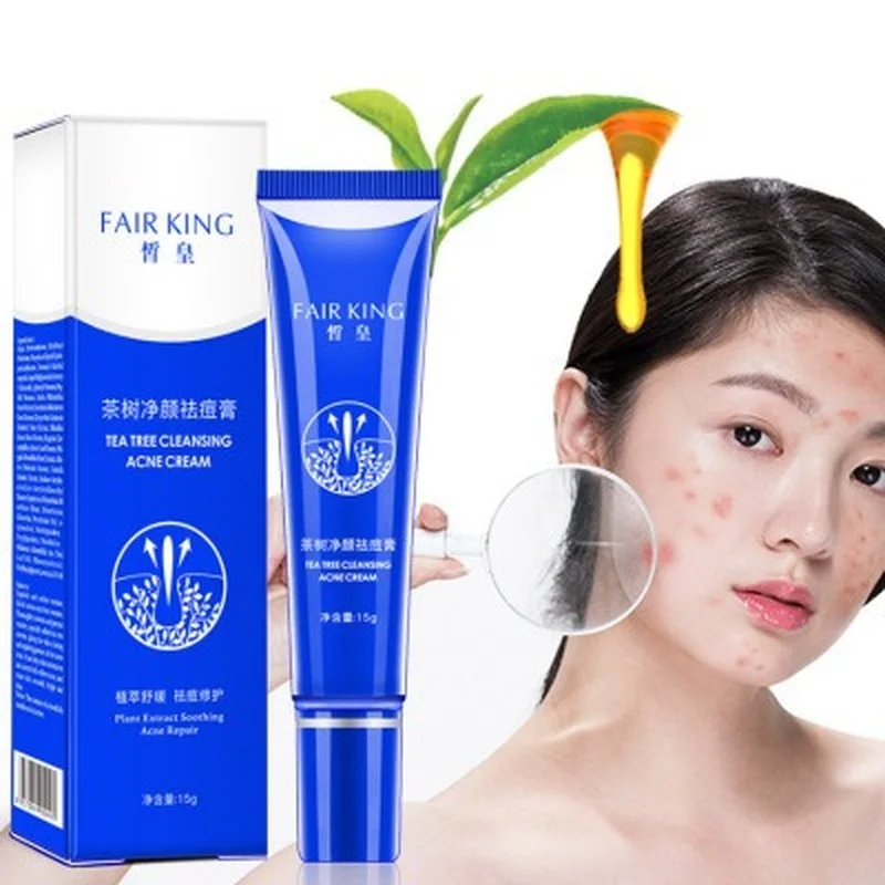 

Facial Acne Cream Whitening Moisturizing Oil Control Shrinking Pores Diminishing Acne Marks Natural Herbal Anti-acne Skin Care