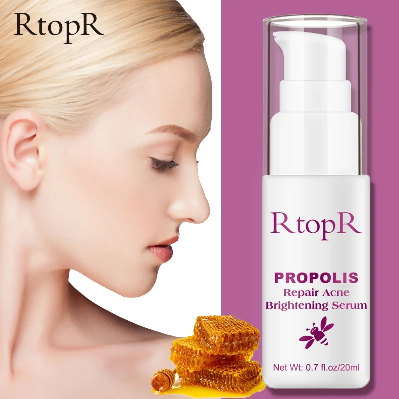 

RtopR Propolis Repair Acne Brightening Serum Acne Scar Spots Cleaning Serum Shrink Pores Eliminates Acne Treatment Oil control
