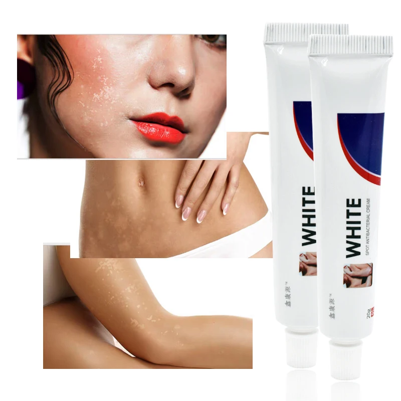20 г Китайский медицинский крем с белыми пятнами пигмент меланин стимулирующий
