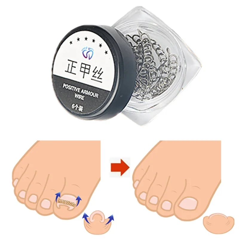 6 шт. коррекция вросших пальцев ног педикюр проволока из нержавеющей стали