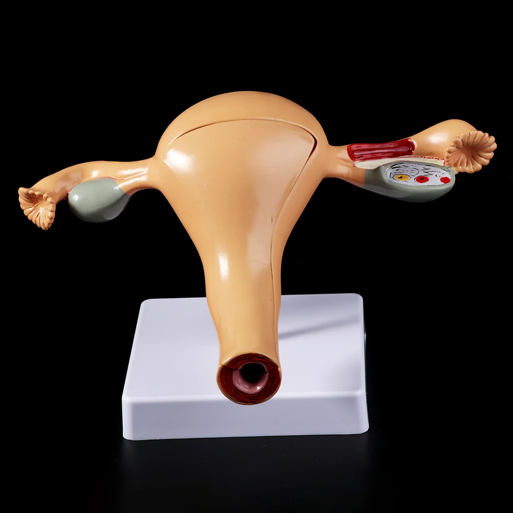 

Human Pathological Uterus Ovary Model Anatomical Anatomy Disease Pathology Medical Lesion For Teaching