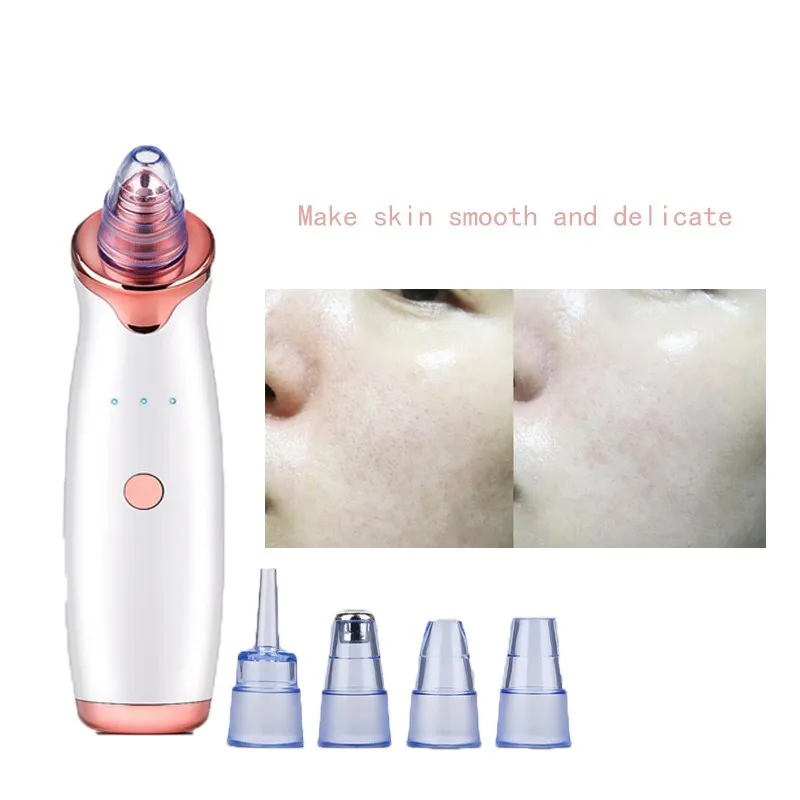 Удаление угрей вакуумный аппарат для очистки пор всасывания уход за лицом черная