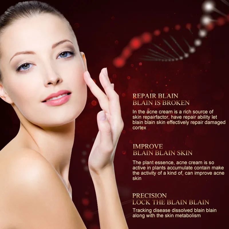 Травяное удаление акне Восстанавливающий увлажняющий крем для лица Питательный