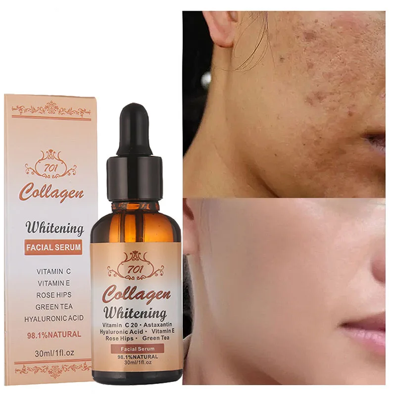 

Vitamin C Whitening Face Serum Lighten Spots Brightening Facial Skin Essence Fade Dark Spots Remove Freckle Speckle Care