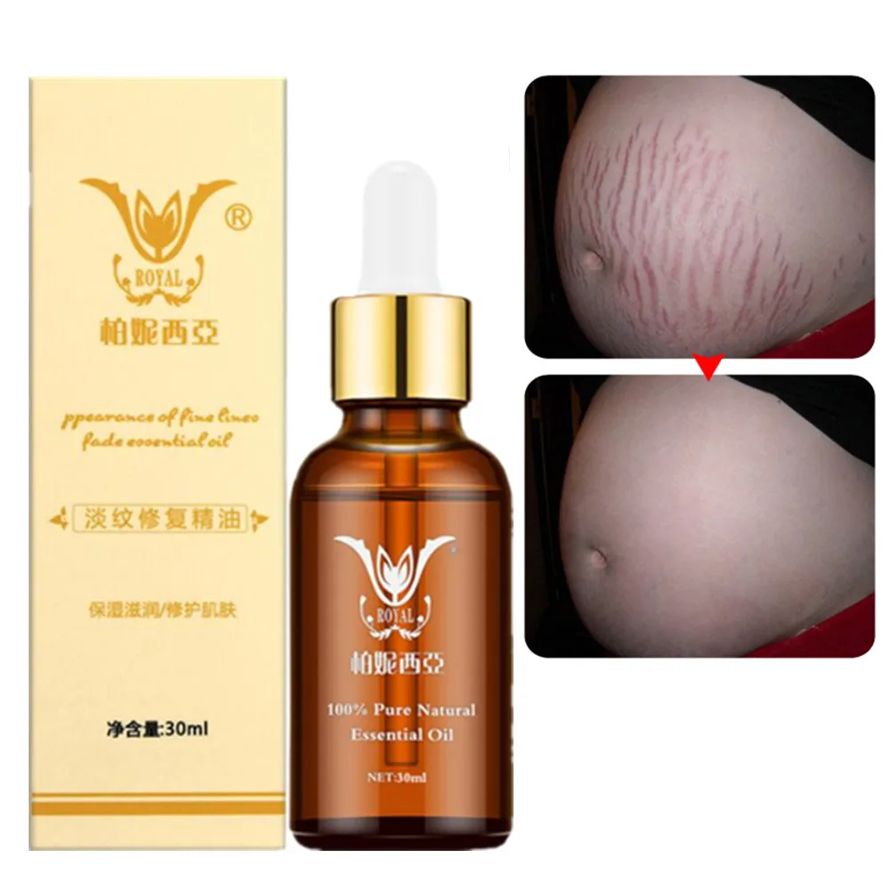 Эфирные масла для Удаления растяжек натуральное средство удаления ожирение