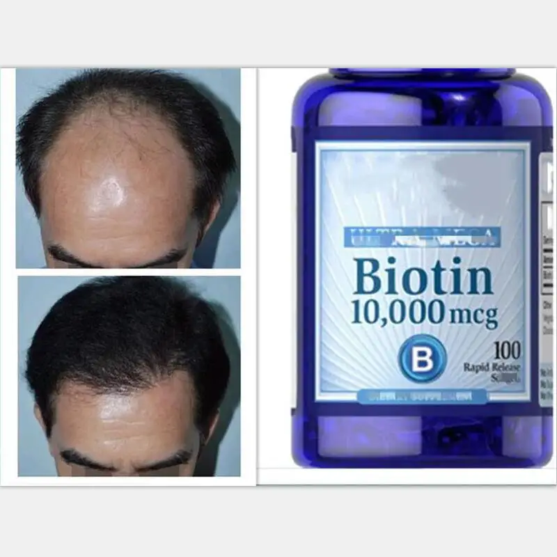 

2 Bottles Biotin Adult B7 Vitamin H Prevent Hair Loss Hair Health 100 pcs /bottle