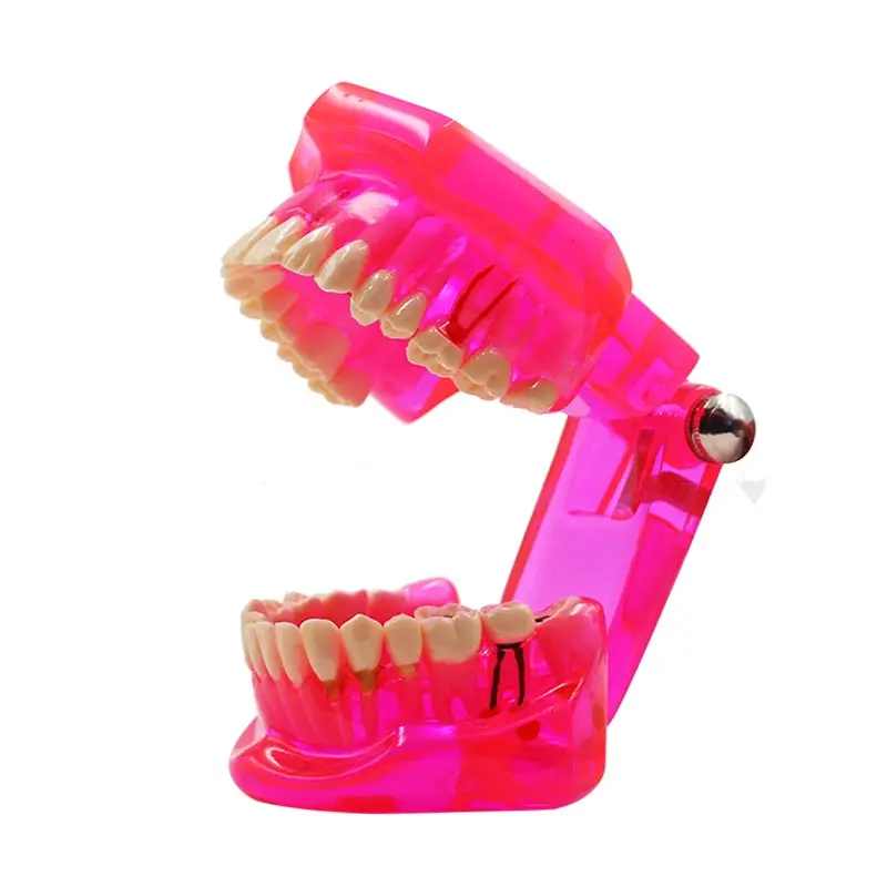

1pc Dental Teeth Teaching Model Adult Pink Removable Tooth Orthodontic Standard Model For Patient Communication Study Model
