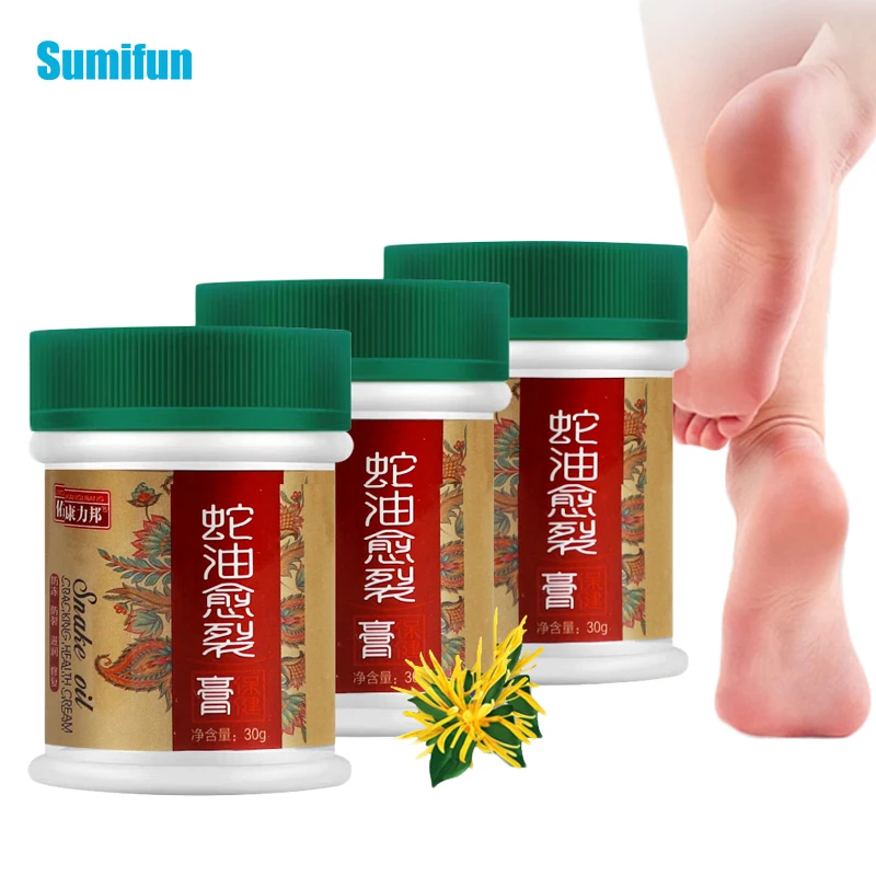 

30 г под змеиную кожу с покрытием против жира крем от трещин крем для ног анти-пилинг на потрескавшуюся кожу мазь против Inplammation удалить омерт...