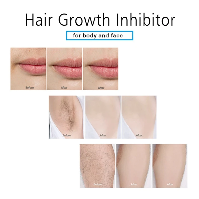 New Hair Growth Inhibitor Pubic Repair Spray Facial Remover Aloe Extract Reduce Density 20ml | Красота и здоровье