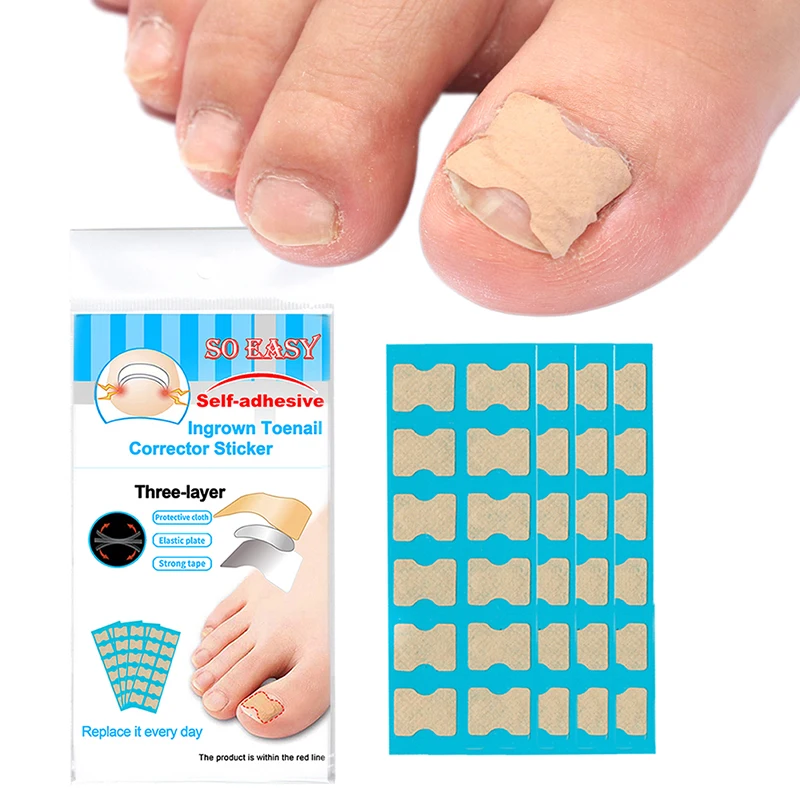 

Pedicure Ingrown Nail Tools Toenail Stickers treatment Corrector Paronychia Treatment Fixer Recover Bunion Pedicura Feet Care