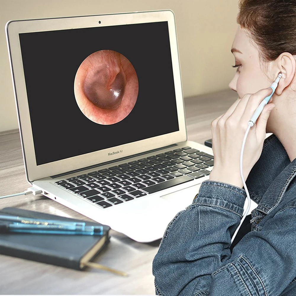 

In Ear Cleaning Endoscope USB Visual Ear Spoon 5.5mm 0.3MP Mini Camera Android PC Ear pick Otoscope Borescope Tool Health Care