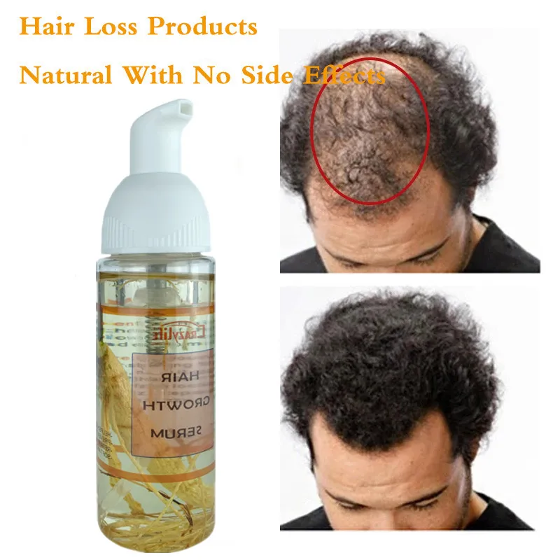 

50ML Ginseng Rose Hips Fast Hair Growth Serum Essential Oil Anti Preventing Hair Lose Liquid Damaged Hair Repair Growing