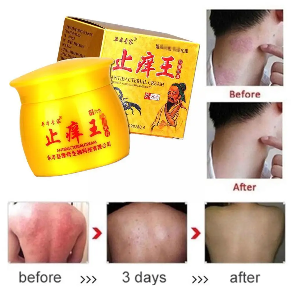 

Крем от псориаза K8W1, средство для ухода за кожей, дерматита и экземы