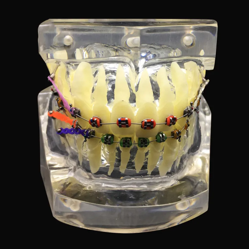 

Стандартная Стоматологическая Ортодонтическая модель, прозрачная коррекция зубов, Дисплейные модели с кронштейном, лигатурная проволока ...