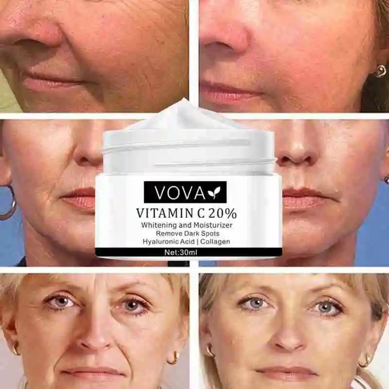 

White Freckle Cream Vitamin Cream Whitening Dark Spots Nourish Melanin Skin Vitality Remove Skin Awaken 30Ml Cream B8C6