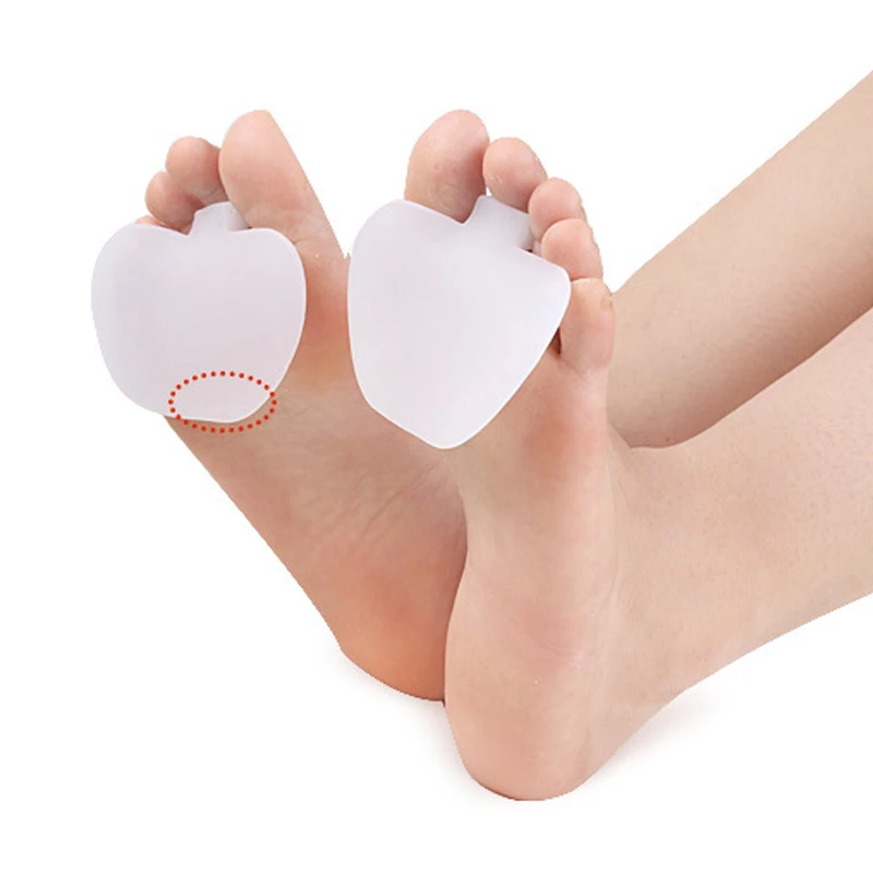 Вальгусная коррекция при вальгусной деформации силиконовые разделители для