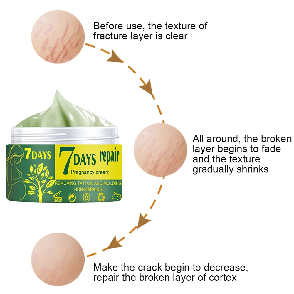 Крем для восстановления и ухода за кожей после беременности крем удаления шрамов