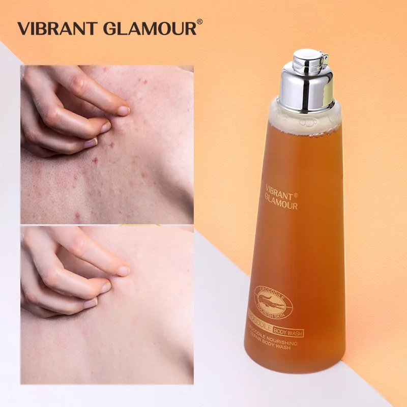 

VIBRANT GLAMOUR Crocodile Nourishing body wash Removes Dirt And Oil Reduce Acne Deep Cleansing Improve chicken skin body care