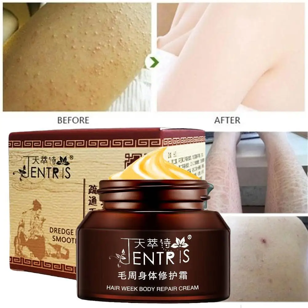 

50g /ml Curing Keratosis Pilaris Kp Chicken Skin Repair Cream Body Lotion Skin Skin Care Essence Moisturizing And Nourishing