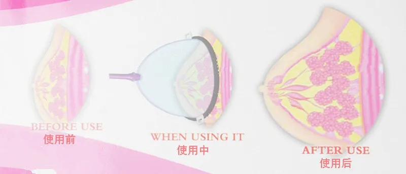 Новинка 2019 вакуумная терапевтическая машина для подтяжки ягодиц и груди