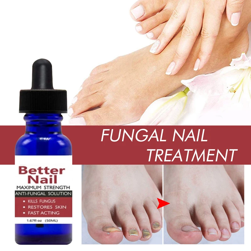 50ml Nail Repair Liquid Anti Fungus Toe Serum Remove Onychomycosis Essence Treatment Hand Foot Care ZGO | Красота и здоровье