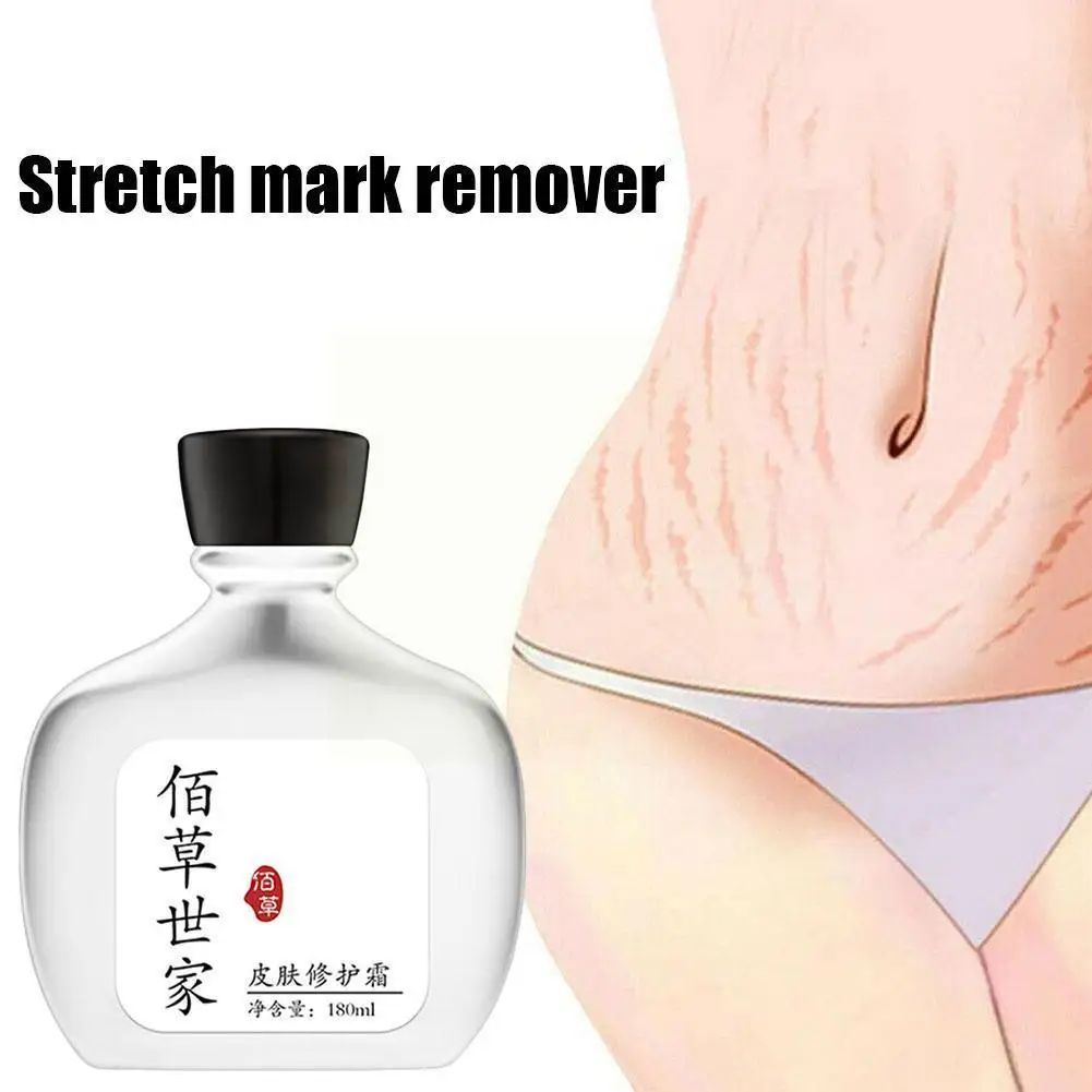 

180ml Stretch Marks Removal Cream Pregnancy Repair Women Obesity Skin Care Cream Cream Body Postpartum M0U1