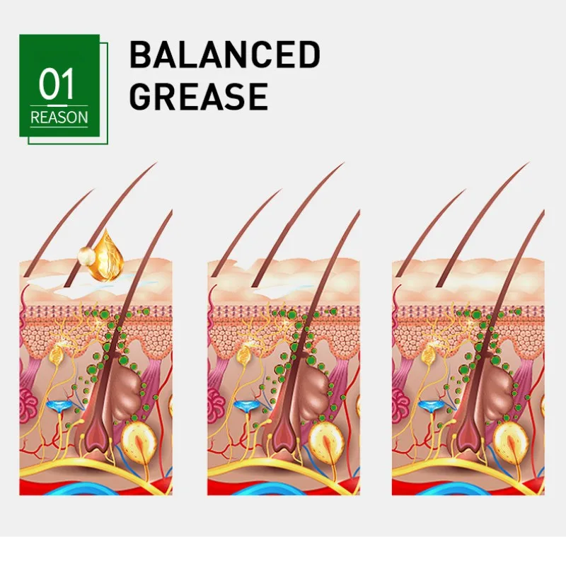 

Anti-hair Loss Essence Growth Fluid Nourishing Hair Scalp Fast Growth Hair Regrowth Serum