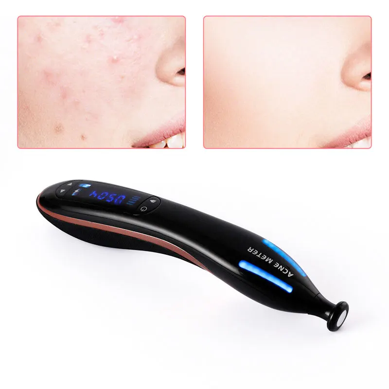 Плазменная ручка для удаления шрамов акне пятен против морщин терапия старения