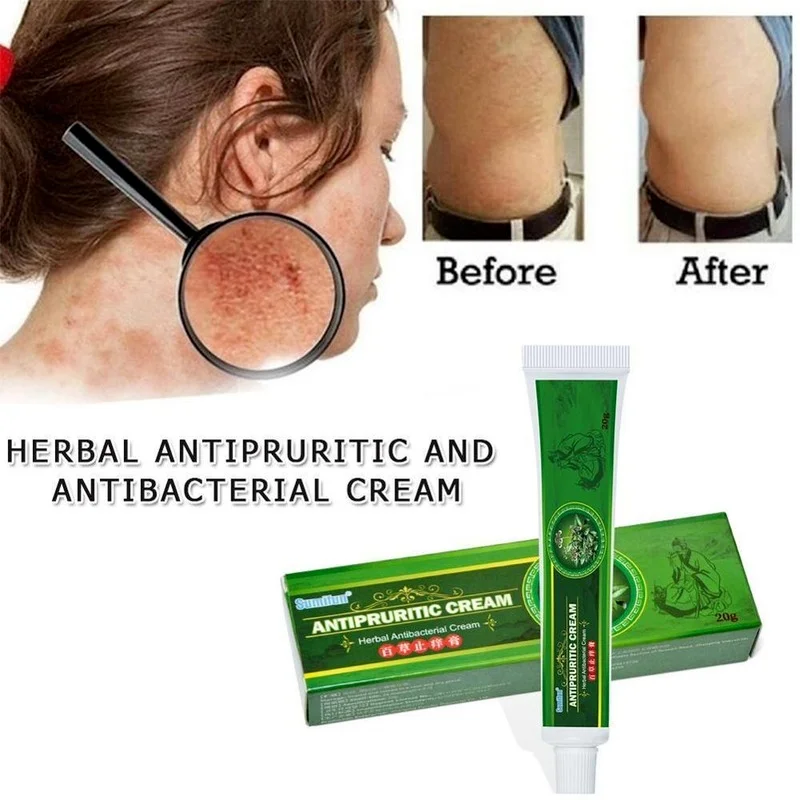 

Skin Psoriasis Cream Dermatitis Eczematoid Ointment Cream Cream Eczema Treatment Psoriasis Skin Care Body Skin Whitening