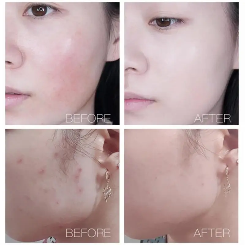 

50ml Aloe Vera Gel, Repair After The Sun Acne Dilute Printing Moisturizing Z2N7