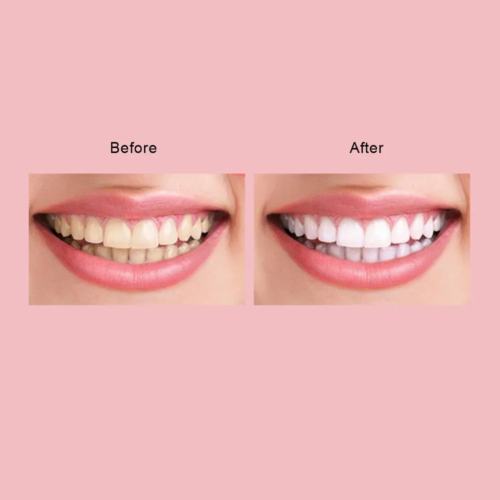 

Electric Toothbrush Rechargeable Toothbrush Sonic Shock Automatic Soft Toothbrush Waterproof Usb Charging