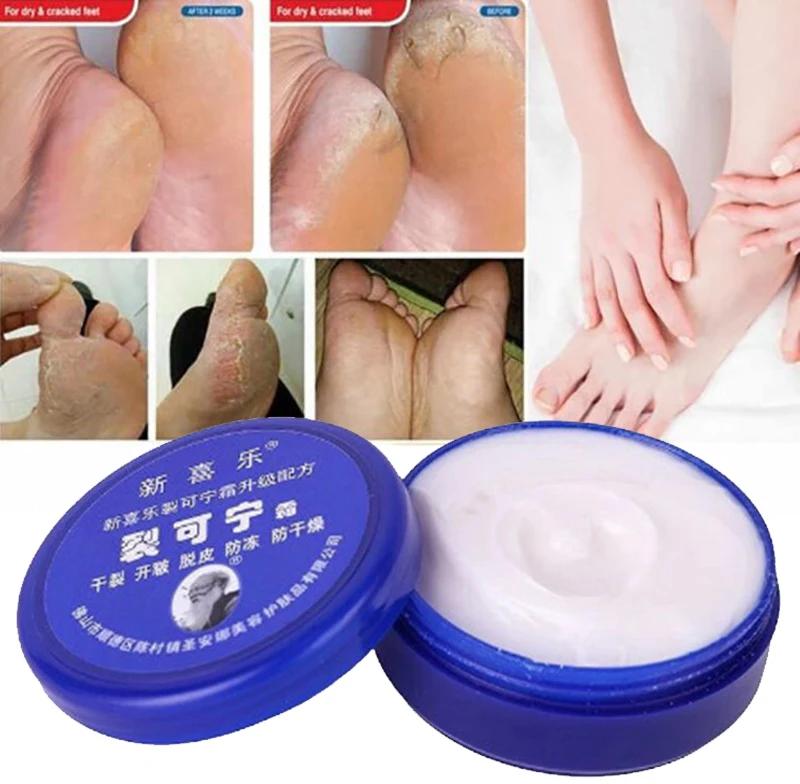 

Traditional Chinese Oil Anti-Drying Crack Foot Cream Heel Cracked Repair Cream Removal Dead Skin Hand Feet Care Ointment 33g
