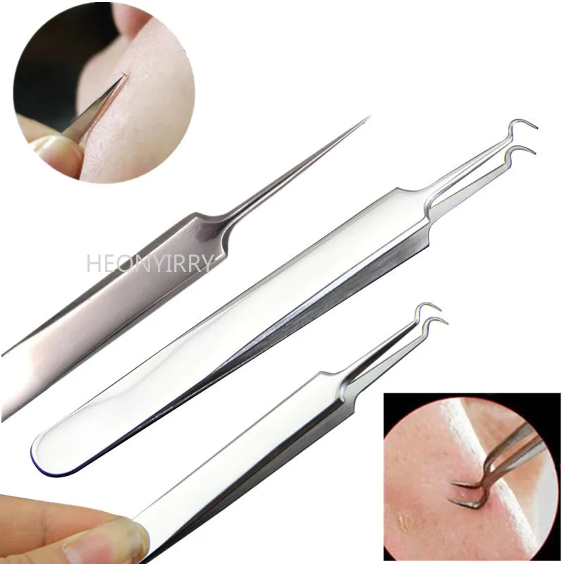 

4 5 7 8 Pc Stainless Steel Blackhead Remover Tool Kit Whitehead Pimple Spot Comedone Acne Extractor Remover Popper Beauty Tool
