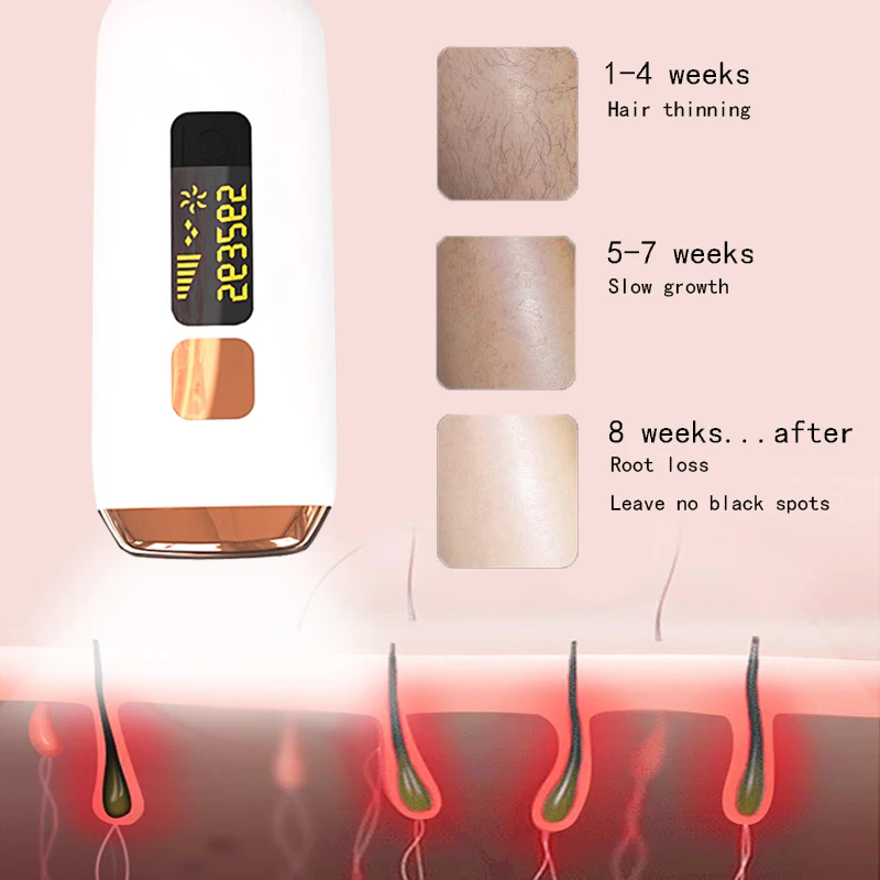 Kemei Epilator Lady Электрическая эпиляция для удаления волос Идеальная безупречная эпиляция, чистка лица, аккумуляторная 5