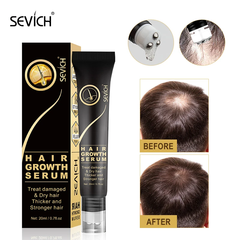 

Sevich масло для быстрого роста волос 20 мл натуральный загуститель эссенция против выпадения волос уход за кожей головы массаж ролик лечение р...