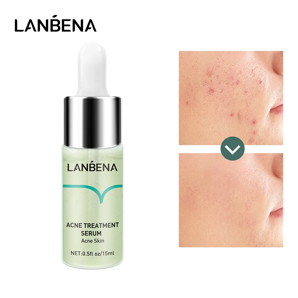 

LANBENA Face Serum Shrinking Pore Acne Treatment Deep Cleaning Whitening Smoothing Skin Care Firming Essence Scar Pimple Removal