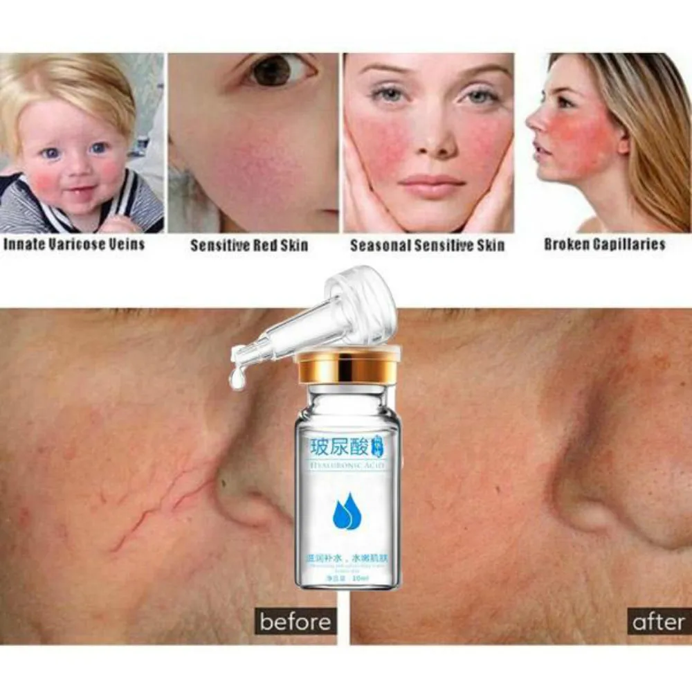 Шелковое эфирное масло с гиалуроновой кислотой для удаления покраснений на лице