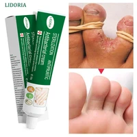 herbal foot treatment nail fungus removal anti fungal infection onychomycosis paronychia toe fungus repairing ointment feet care