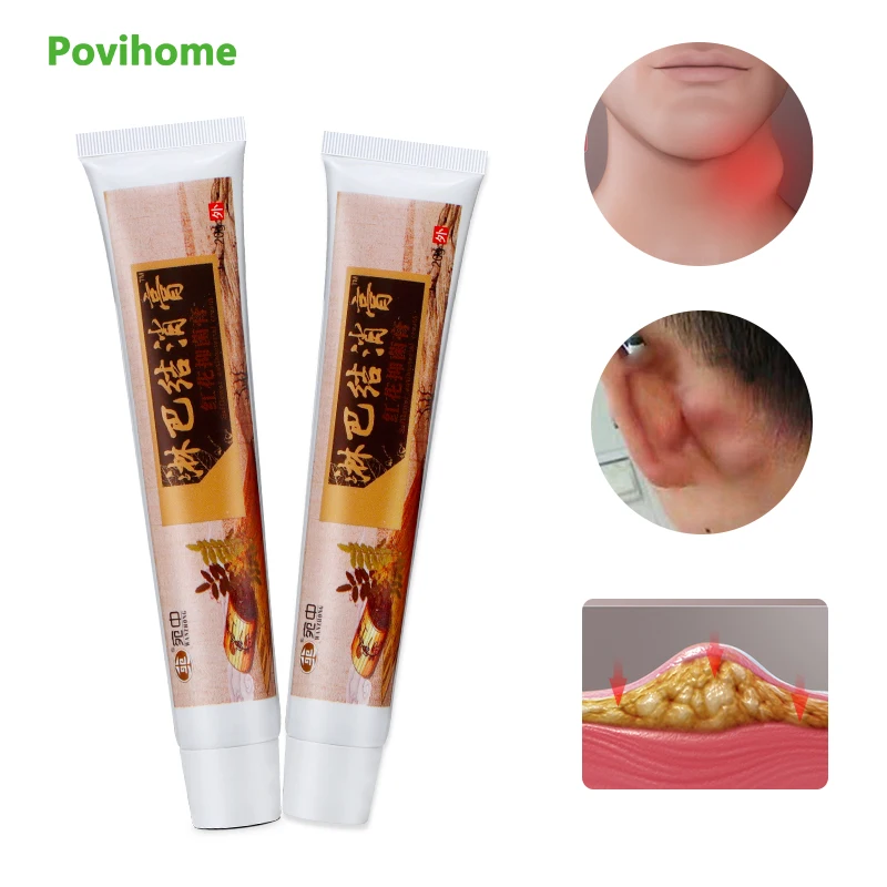 

20g Lymphatic Detox Cream Anti-Swelling Breast Neck Lymph Nodes Reduce Swelling Chinese Medical Plaster Pain Relief Ointment