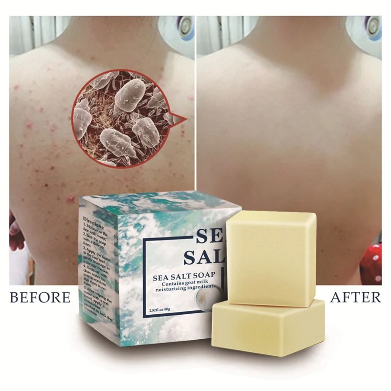 Эффективное восстанавливающее клещи питает кожу лица очищающее мыло против