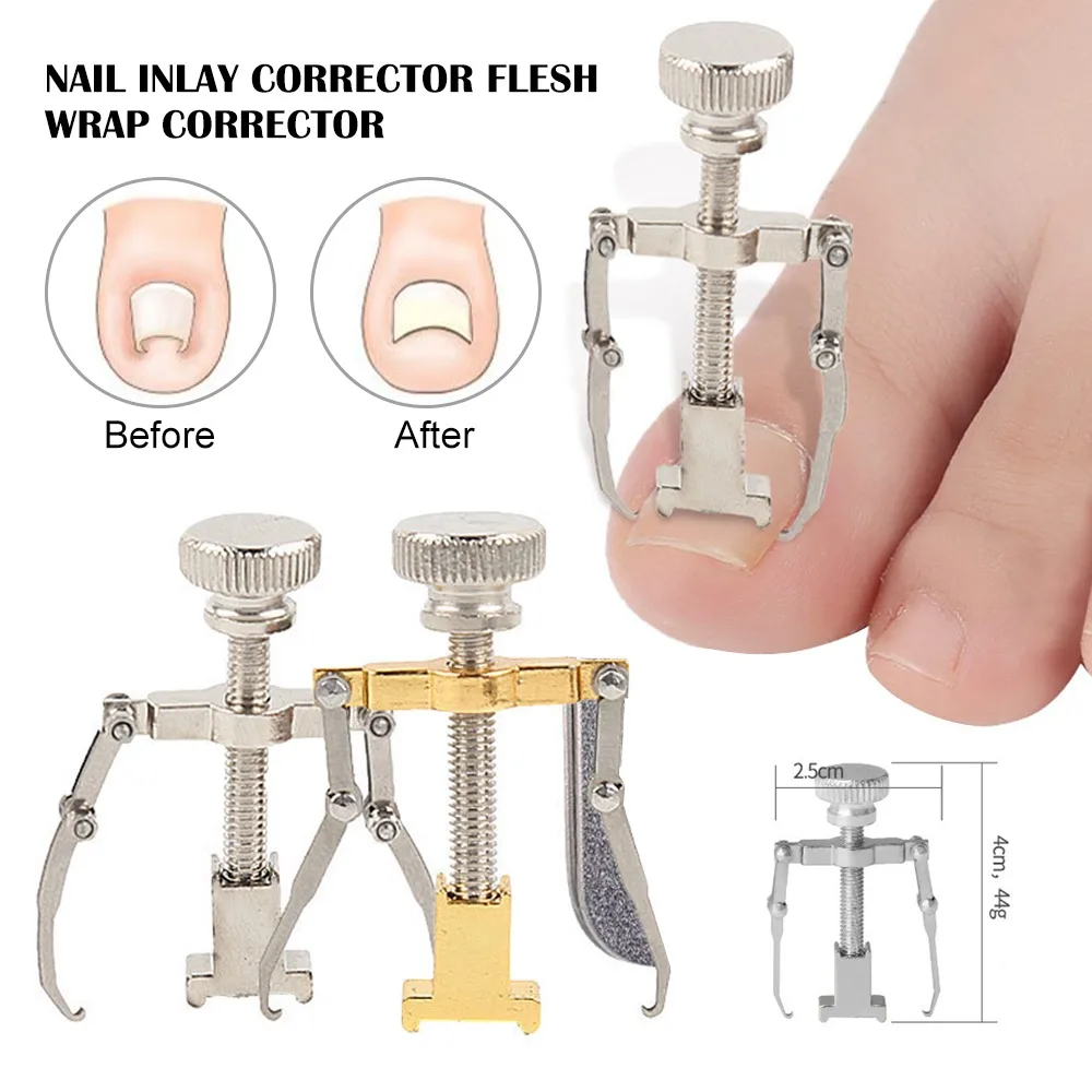 

Ingrown Toenails Correction Pedicure Foot Toe Nail Care Straightening Clip Brace Corrector Ingrown Toe Nail Fixer Foot Care Tool