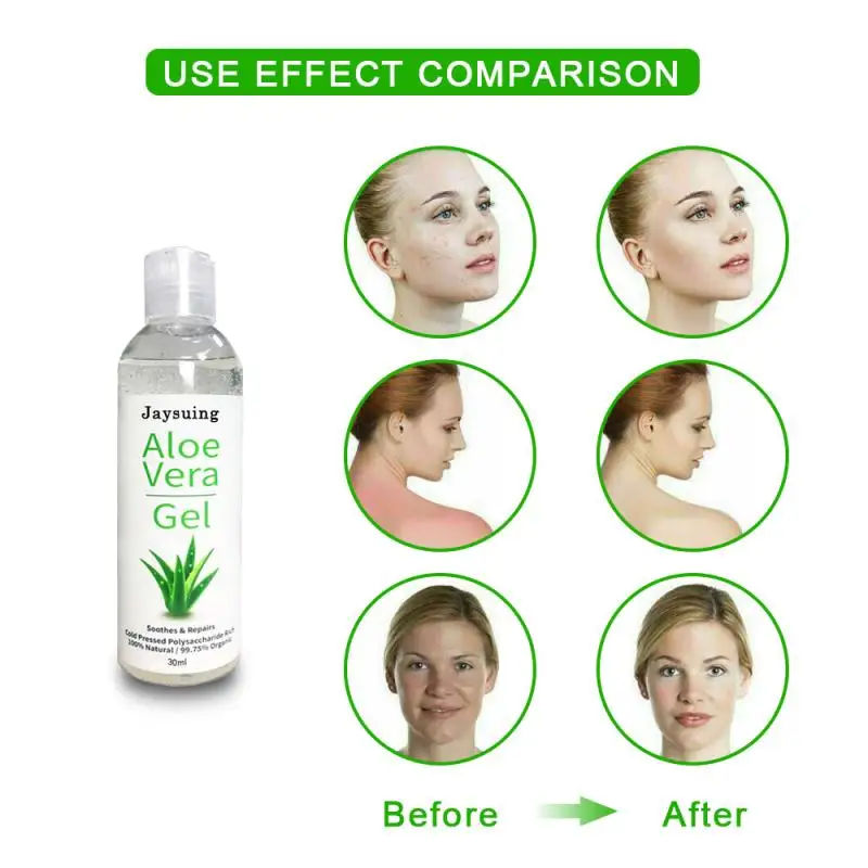 30ml/50ml Aloe Vera Gel Cream Moisturizing Hydrating Whitening Anti Wrinkle Remove Dark Circle Skin Care Day Creams TSLM1 | Красота и