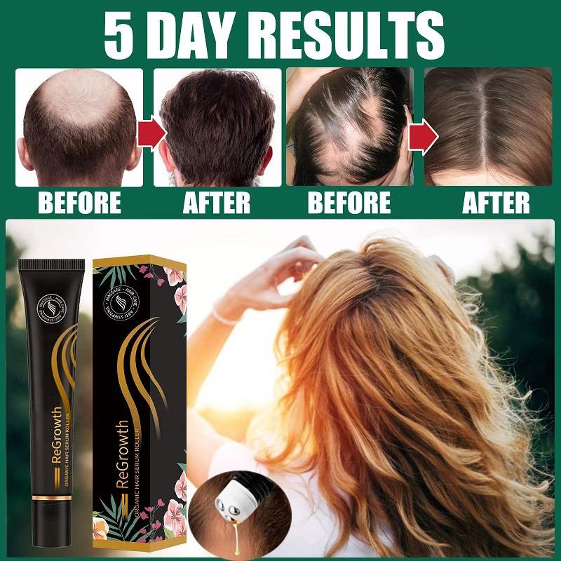 Масло для роста волос экстракт женьшеня имбиря сыворотка предотвращение