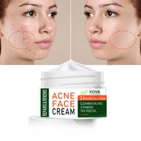vova effective acne removal cream acne treatment fade acne spots oil control shrink pores whitening moisturizing skin care 30ml