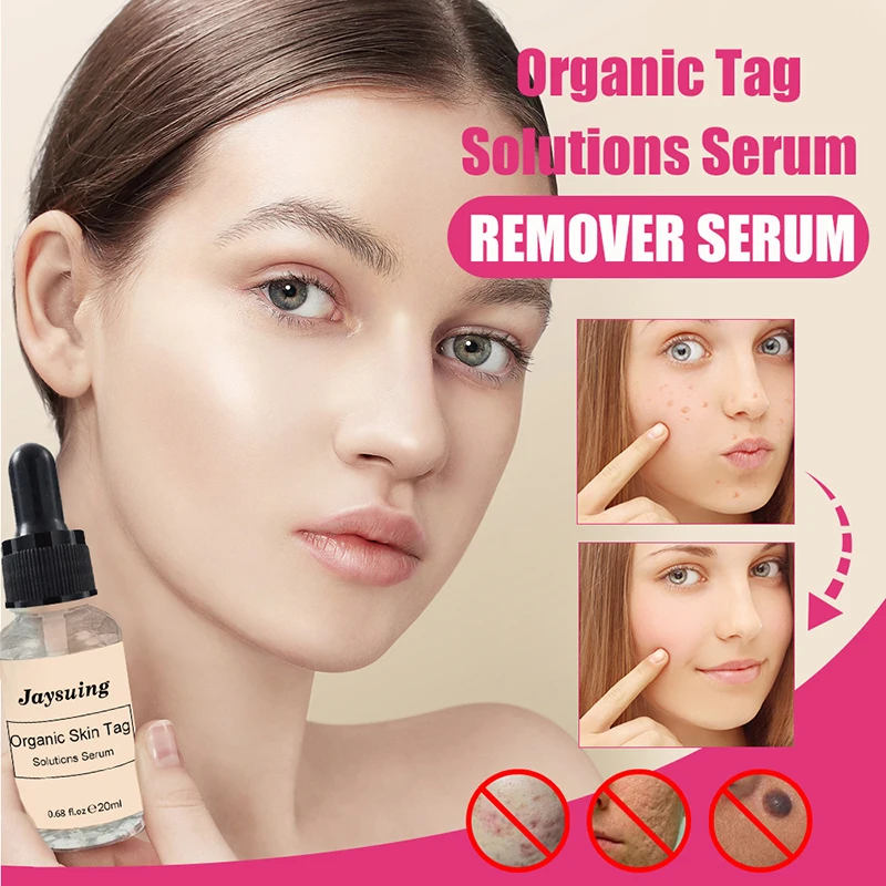 

10/20ML Organic Tags Solutions Serum Skin Tag Remover Serum Painless Mole Skin Dark Spot Freckle Remover Cream Oil Plaster