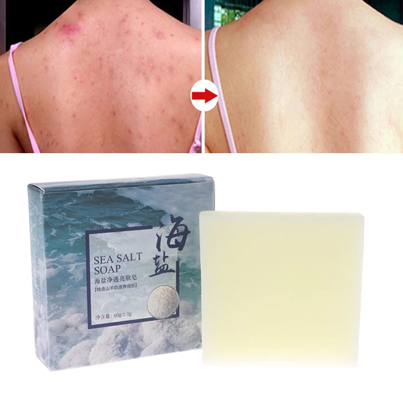 Мыло с морской солью для очищения лица средство удаления прыщей и акне