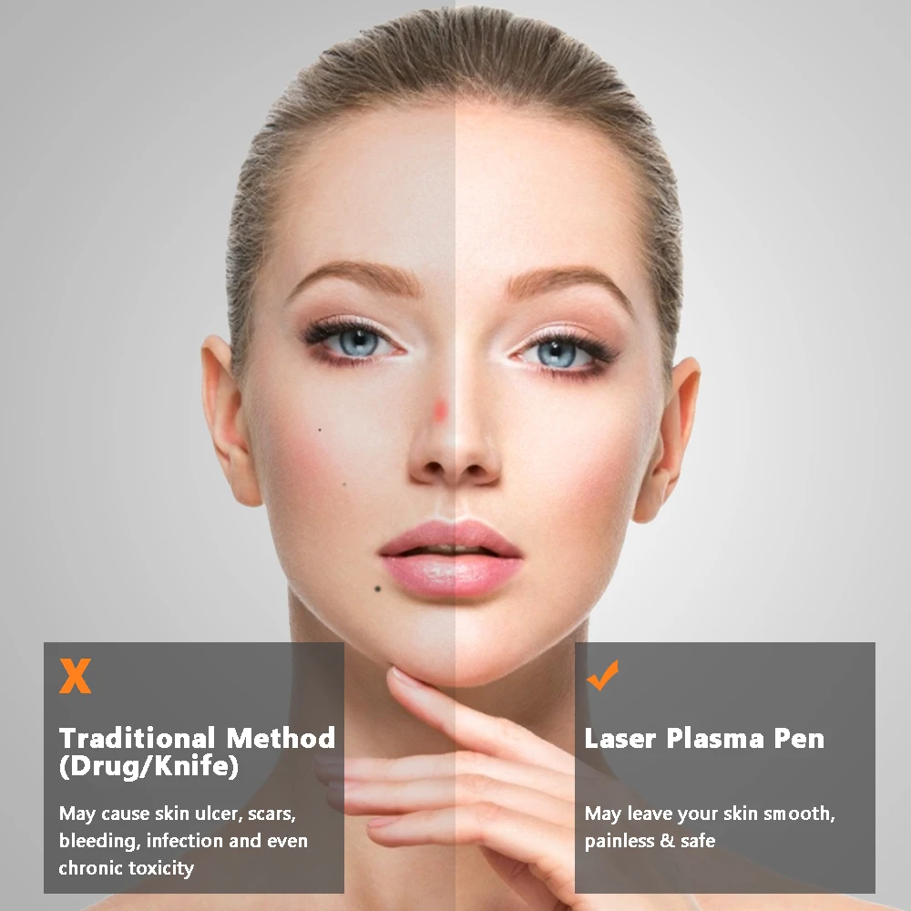 

Plasma Pen Mole Freckle Removal Dark Spot Remover LCD Skin Care Point Pen Skin Wart Tag Tattoo Removing Tool Beauty Care