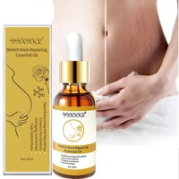 stretch marks remover essential oil skin care treatment cream for stretch mark removal maternity slackline for pregnant oils